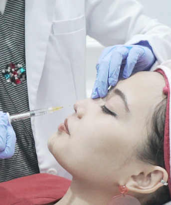 Suntik Filler (Dermal Filler)