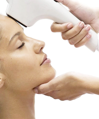 Intense Pulsed Light (IPL)