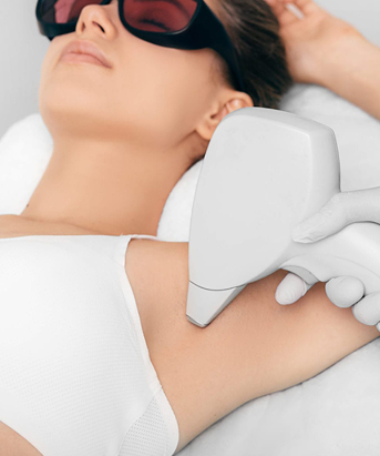 Hair Removal with IPL