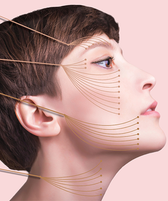 Threadlift (Tarik Benang)